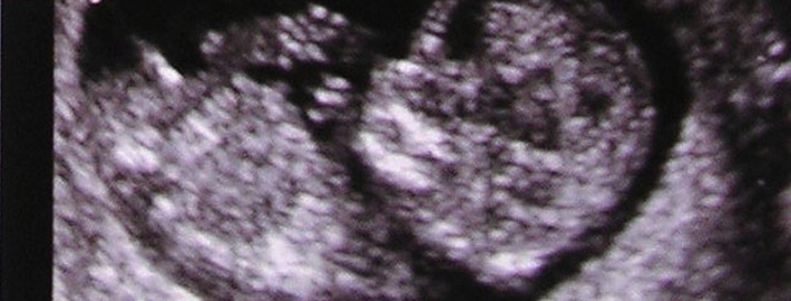 pruebas durante el embarazo 2